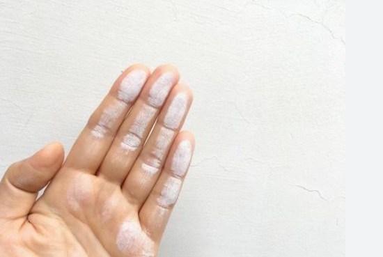 チョーキング　画像